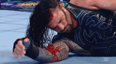 DESTINY #35 - EMBUSCADE. WWE-Wrestlemania-34-Brock-Lesnar-Roman-Reigns-elbow-blood-gif